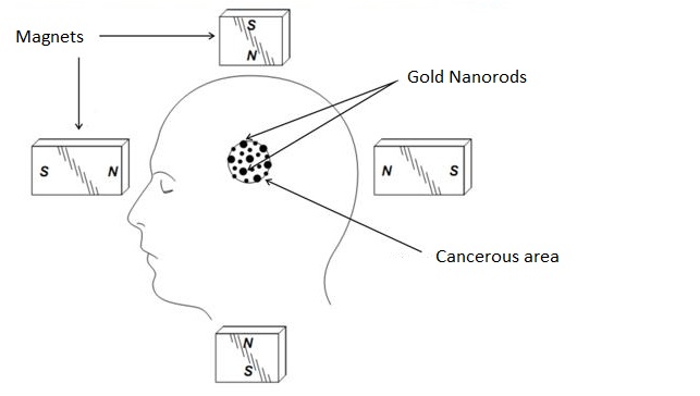 Magnets push diamegnetic nanoparticles into a cancerous area.